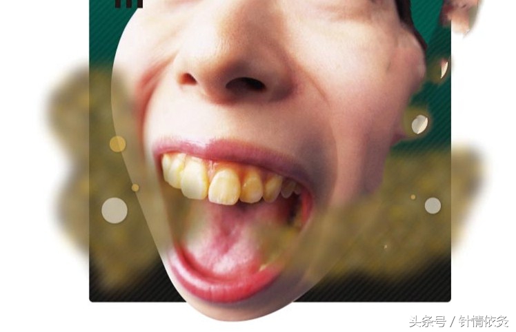 针灸治疗口臭的最佳穴位,针灸治口臭偏方大全视频