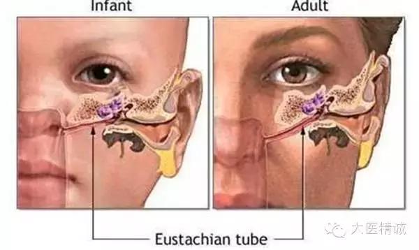 游泳耳朵进水了怎么办啊,游泳如何防止耳朵进水