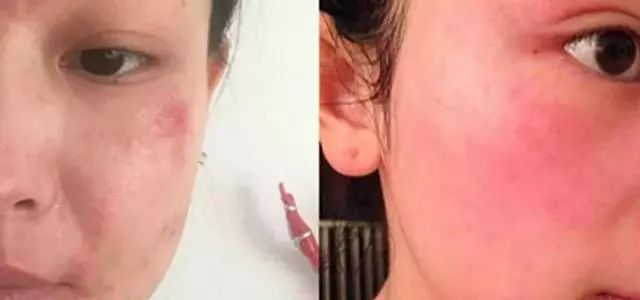 28天白一度美白套装,泰国米皂美白