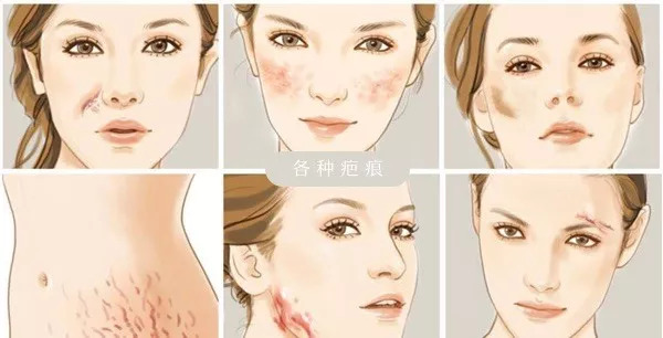 想脸更紧致一点做什么医美,想脸上皮肤好要做什么