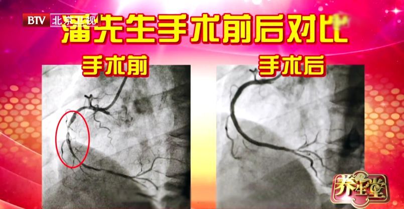胸痛突发,感到胸痛要警惕四种病
