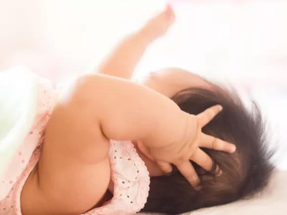 去除婴儿头上乳垢,去除胎儿乳痂