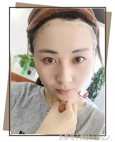 烂脸救星医美面膜到底能不能用,医美面膜和其他面膜有什么区别