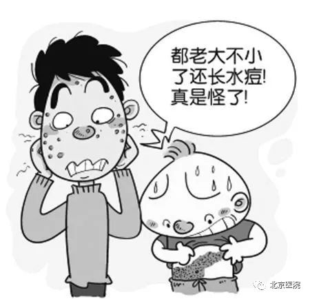 京医科普｜不长在腰上也是缠腰龙吗？