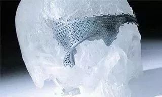 为了避邪，杀人犯在被害者脑子里种了一棵桃树