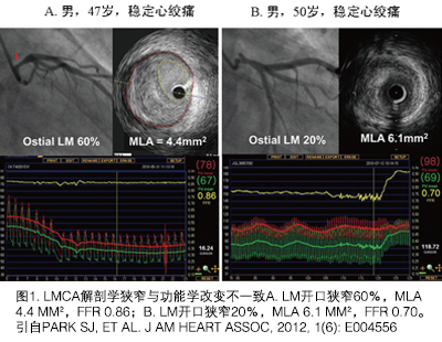 心脏血管狭窄95%必须下支架吗,心脏血管狭窄80%一定要下支架吗