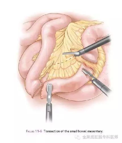 如何正确认识便秘的危害,功能性便秘的诊断标准
