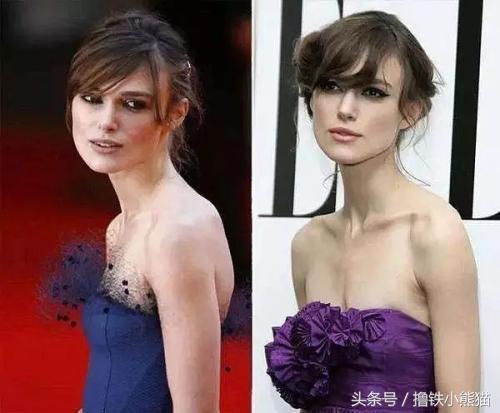 把驼背变成直背,舞蹈驼背应该怎样把背练直呢