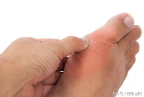 老人痛风吃什么食物最好降尿酸,痛风吃什么食物最好降尿酸