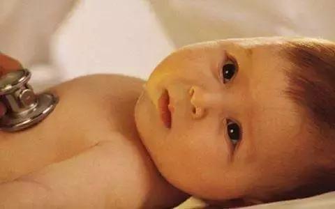 新生儿黄疸引起原因通俗易懂,新生儿黄疸会导致死亡吗