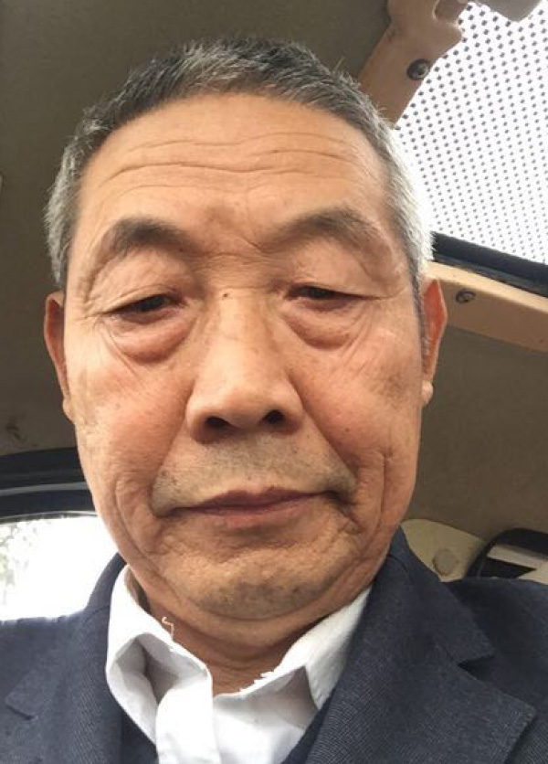 肾囊肿手术二十八天,肾囊肿切除手术失败