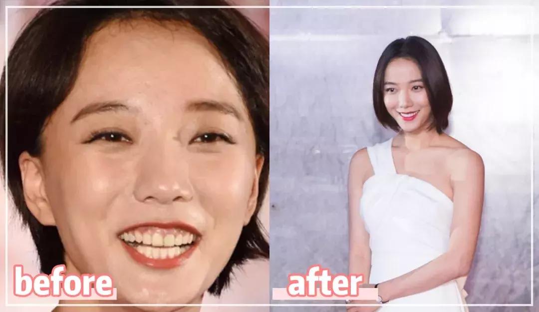 囧！天仙脸配上大黄牙，这是什么操作？！