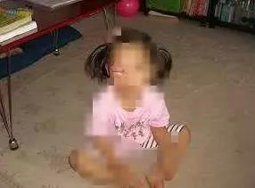 看了不该看的？4岁女童长了一粒小“针眼”,差点丧命！只因为奶奶……