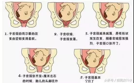 摸肚子能感觉胎儿入盆吗,这些分娩信号你都知道吗