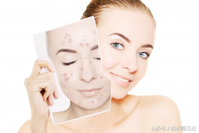 眉中间长痘痘是什么原因怎么调理,眉两边长痘痘是什么原因引起的