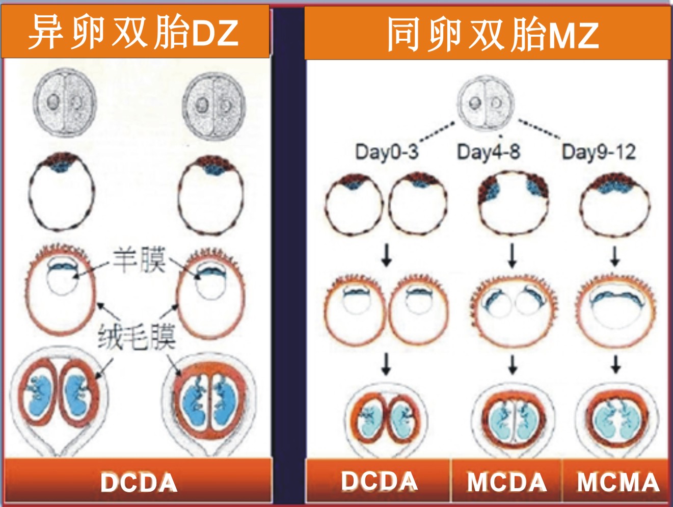 双胞胎分类有哪几种类型,双胞胎分为几种类型