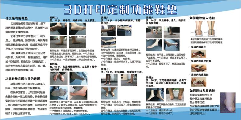 3D打印黑科技鞋垫脚不疼了，还防摔倒