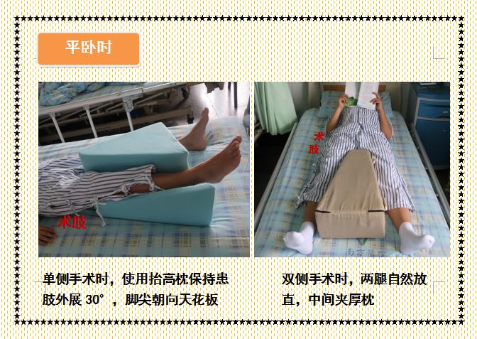 人工股骨头置换术术后教学查房,人工髋关节置换术后护理注意事项