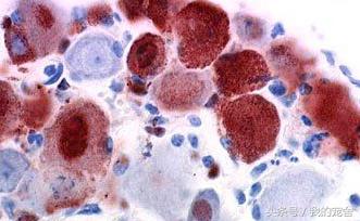 狂犬疫苗的副作用出现哪些症状,狂犬疫苗有副作用是不是有效