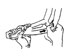 中医骨折治疗原则,中医骨伤整复术
