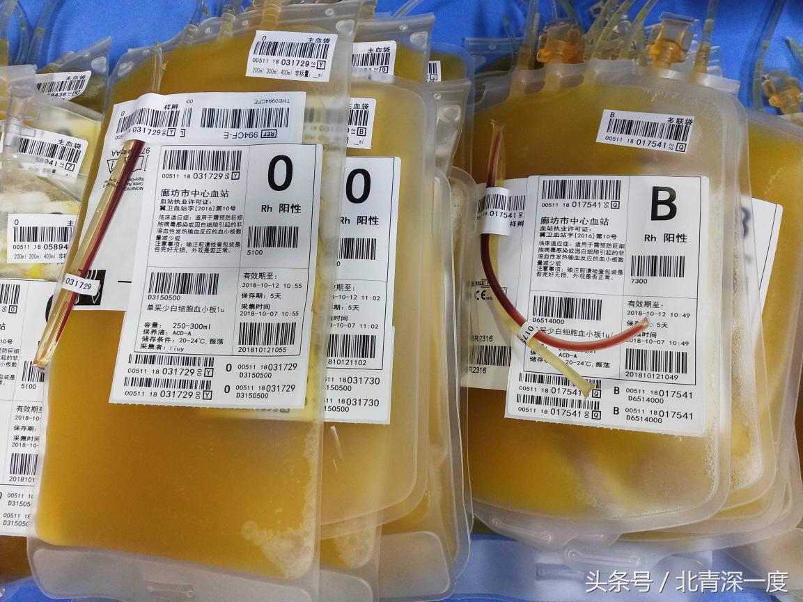 熊猫血怀孕几率到底有多大,熊猫血溶血怀孕