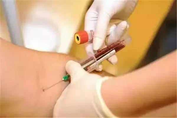 体检一口水都不能喝吗,空腹做体检真的一点水都不能喝吗