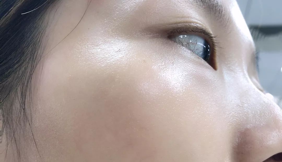 有了全世界3秒卖一瓶的“液体黄金“，干燥、长痘就与你无缘了！