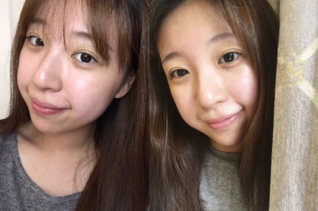 有了全世界3秒卖一瓶的“液体黄金“，干燥、长痘就与你无缘了！