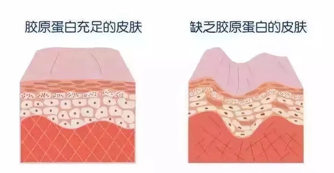 微商胶原蛋白是真的吗,微商胶原蛋白骗局揭秘