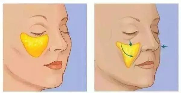 微商胶原蛋白是真的吗,微商胶原蛋白骗局揭秘