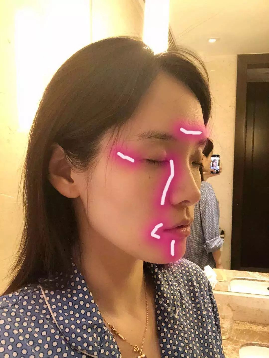 微商胶原蛋白是真的吗,微商胶原蛋白骗局揭秘