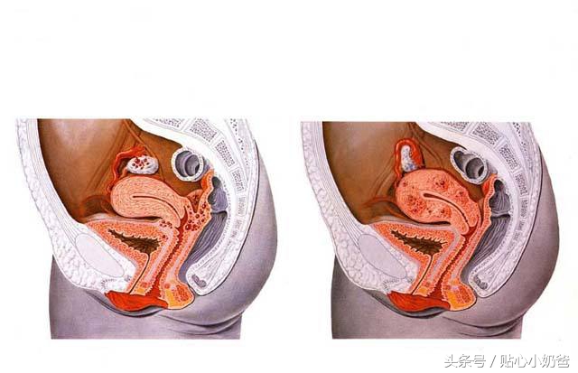 宝妈产后整体修复视频教程,宝妈产后恢复教程