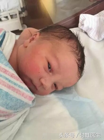 带环会怀孕的宝宝能要不,带环怀孕孩子还能要吗