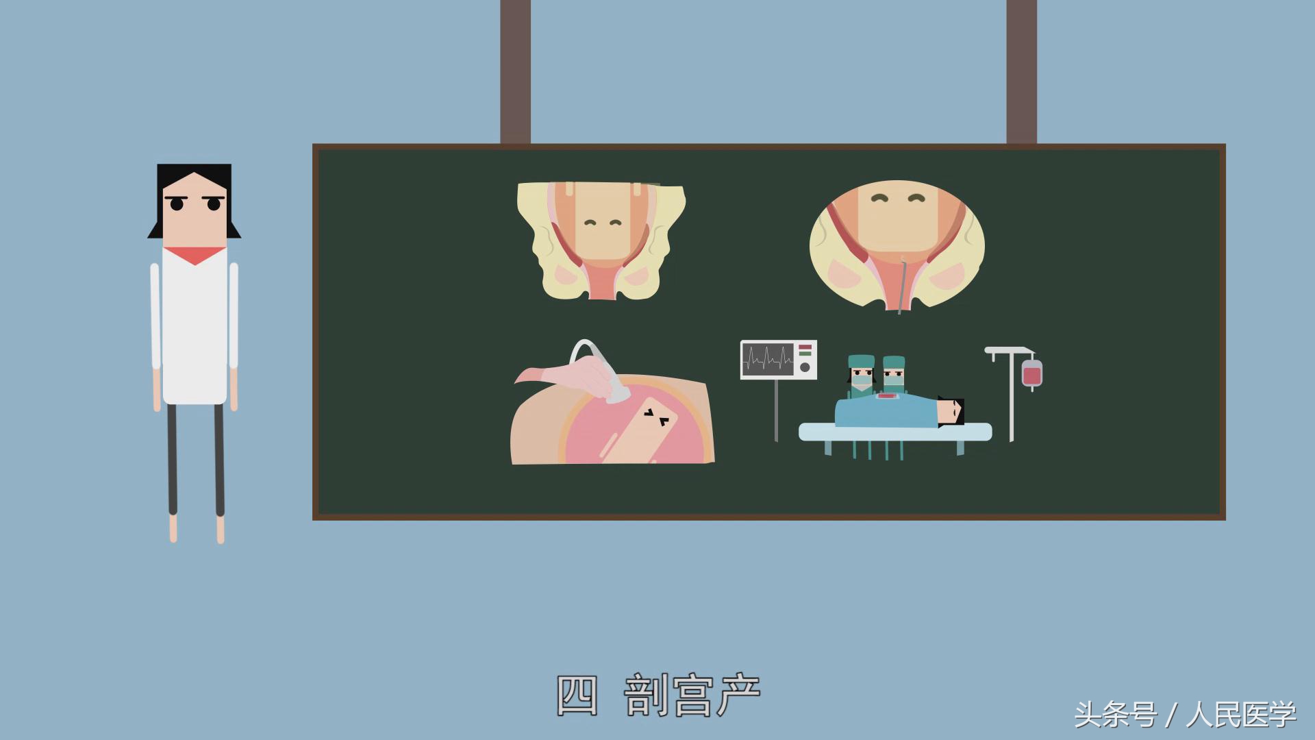 怀孕足月没反应直接剖腹产吗,孕期多少天妊娠反应可以消失