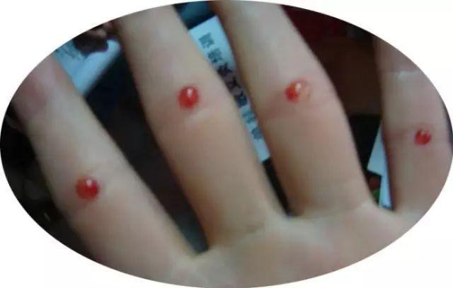 电击教授杨永信所在的临沂网戒所，传出一声声孩子惨叫……