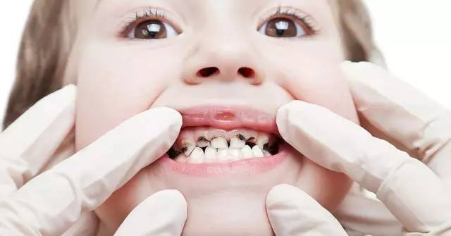 儿童口腔不良习惯的危害和防治,小孩嘴巴臭臭的是消化不良吗