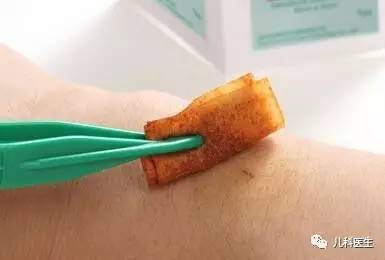 碘伏消毒伤口后容易留疤吗,碘伏消毒伤口会留色素沉着