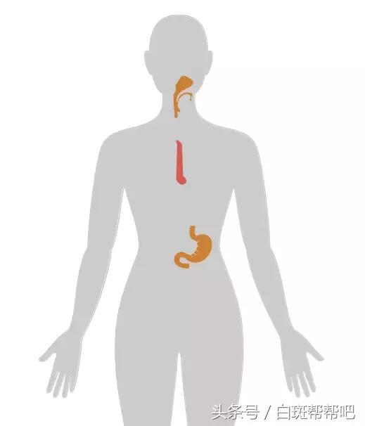 李咏是因为癌症死亡的吗,李咏得的啥癌症为什么葬在美国