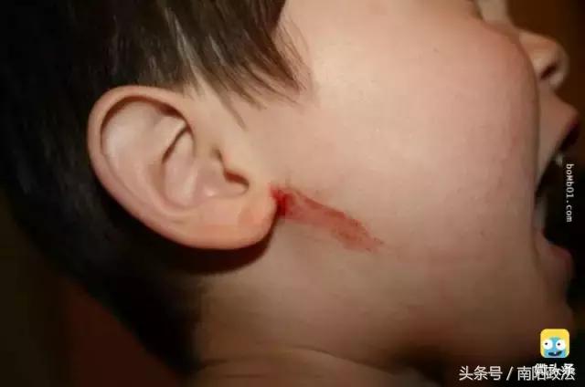 被雷劈是种什么样的体验？看完简直身受同感