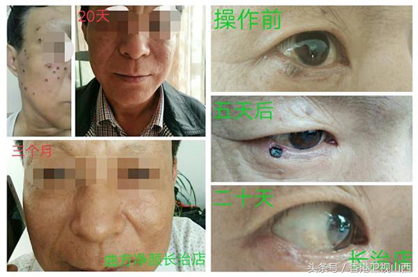 曲方净颜问题性皮肤美容馆,曲方净颜美容护肤中心邯山区店