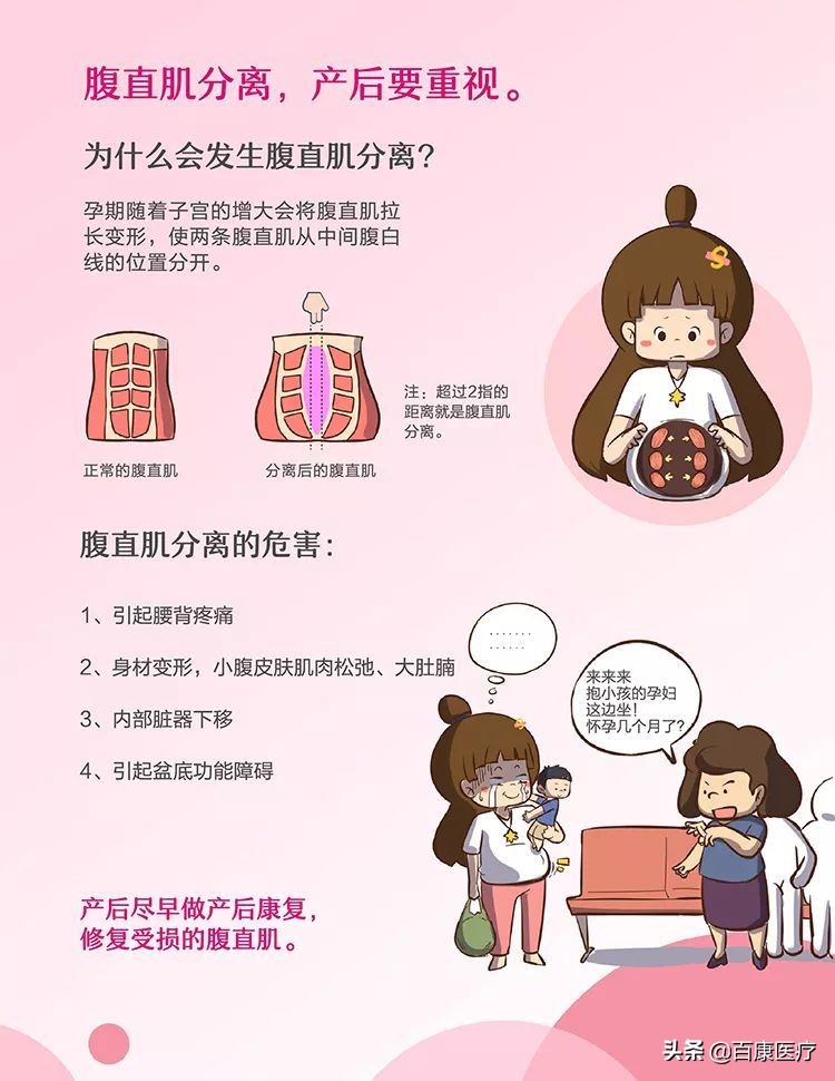 科普视频盆底肌康复训练,盆底肌医学讲解