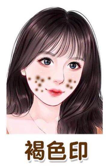 不要化妆品的祛痘小技巧,淡化脸部痘印真实有效的方法