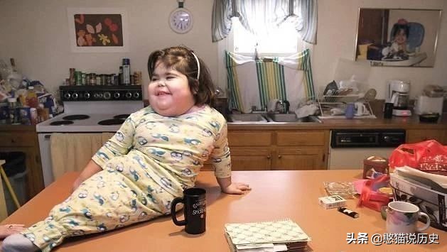 美人鱼真实存在的5件事,美人鱼婴儿畸形手术