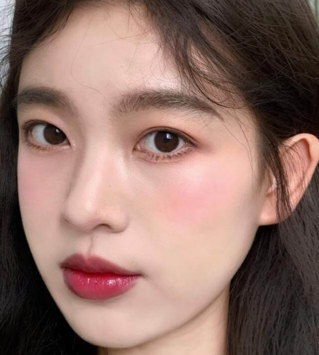 10岁孩子脸上有闭口粉刺怎么处理,脸上的闭口粉刺怎么快速去除