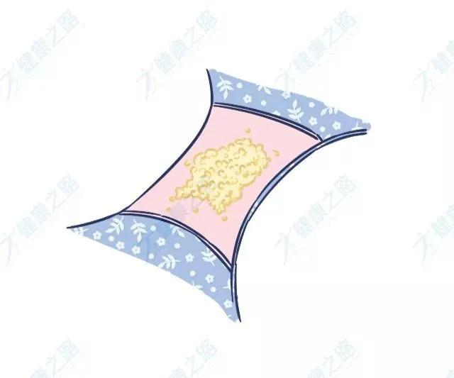 阴道有炎症白带多有什么症状,如果有炎症白带有什么变化