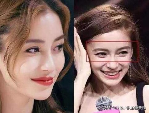 眼周围松弛有皱纹怎么办,眼睛部位皮肤松弛怎么保养