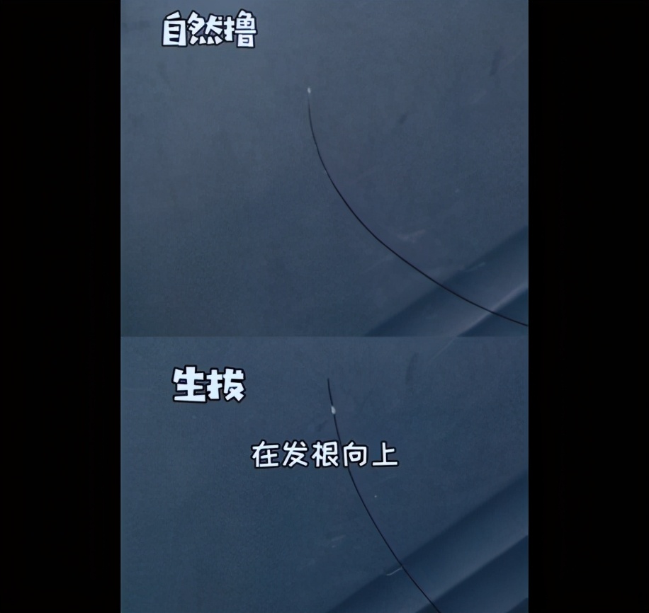 掉发有白色毛囊还会长头发吗,头发掉下来发根有白点是毛囊吗