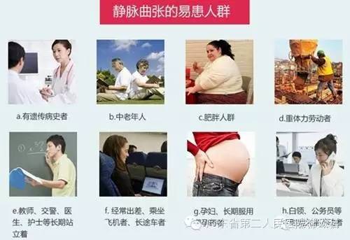 静脉曲张硬化治疗广泛应用…细针解决老难题，难看的蚯蚓腿不见了