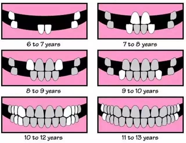 孩子换牙后牙齿越来越难看,小孩换牙为什么牙齿凹凸不平图片