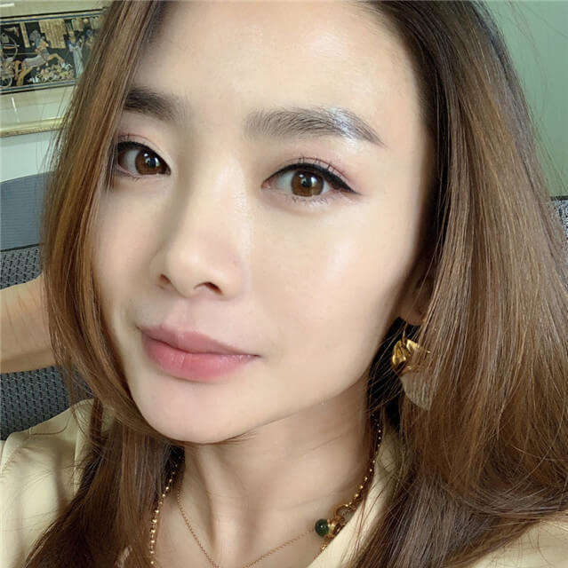 脸上闭口粉刺怎么治疗,脸上闭口粉刺怎么才能彻底处理